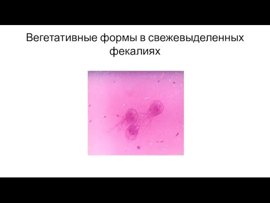 Вегетативные формы в свежевыделенных фекалиях