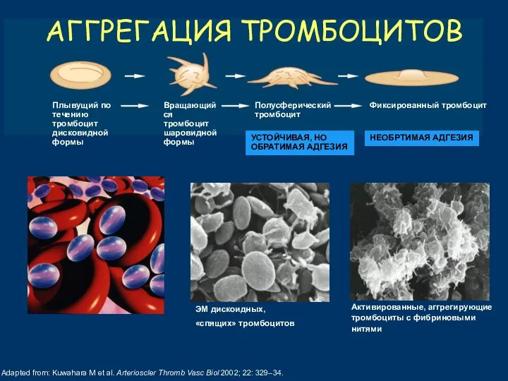 Adapted from: Kuwahara M et al. Arterioscler Thromb Vasc Biol 2002; 22: