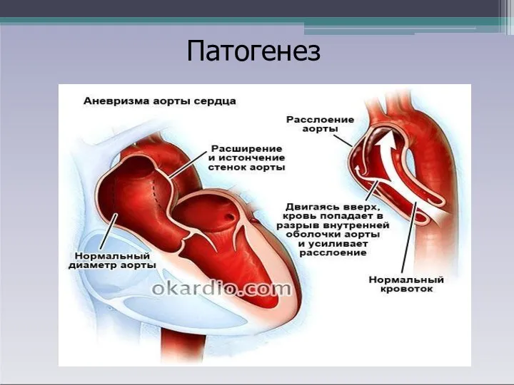 Патогенез