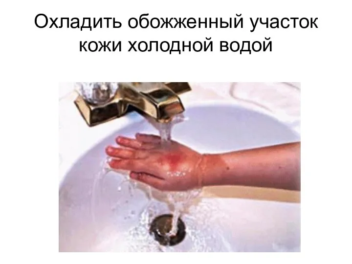 Охладить обожженный участок кожи холодной водой