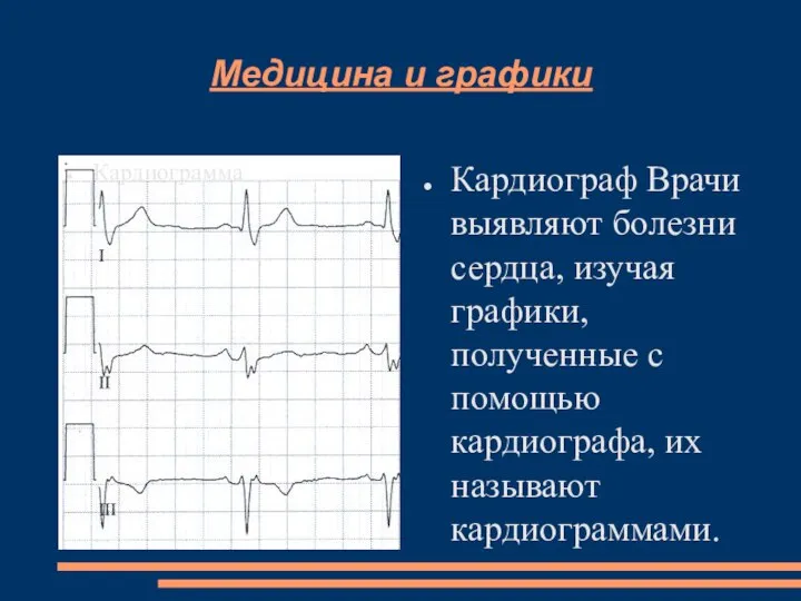 Медицина и графики Кардиограмма Кардиограф Врачи выявляют болезни сердца, изучая графики, полученные