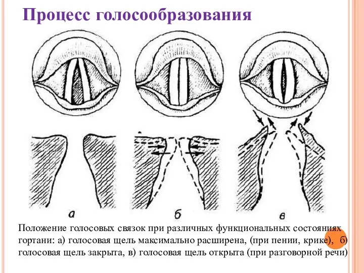 Процесс голосообразования Положение голосовых связок при различных функциональных состояниях гортани: а) голосовая