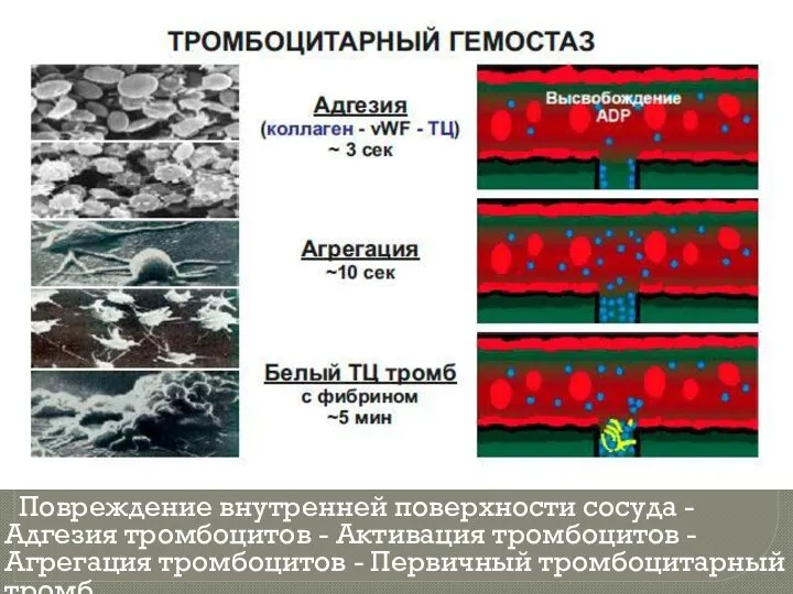 Повреждение внутренней поверхности сосуда - Адгезия тромбоцитов - Активация тромбоцитов - Агрегация