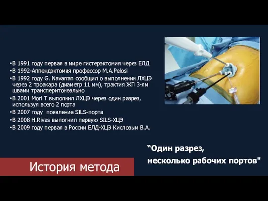 История метода В 1991 году первая в мире гистерэктомия через ЕЛД В