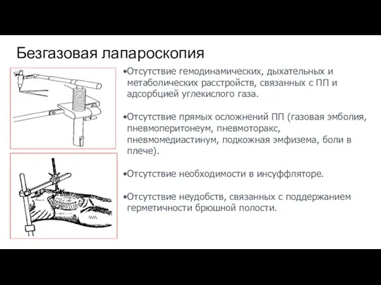 Безгазовая лапароскопия Отсутствие гемодинамических, дыхательных и метаболических расстройств, связанных с ПП и