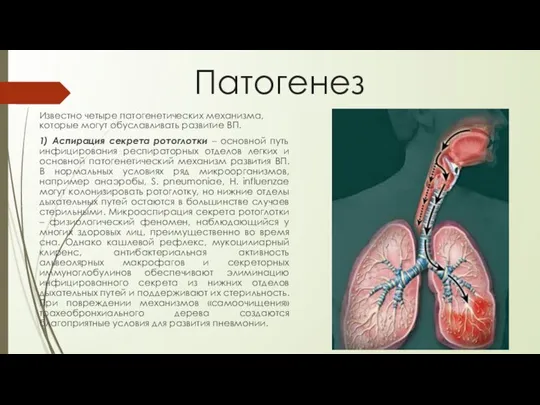 Патогенез Известно четыре патогенетических механизма, которые могут обуславливать развитие ВП. 1) Аспирация