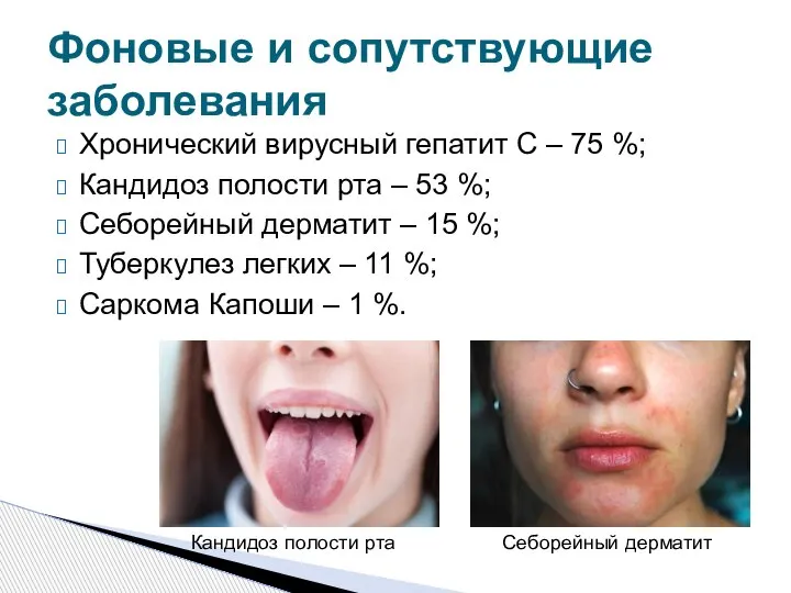 Хронический вирусный гепатит C – 75 %; Кандидоз полости рта – 53