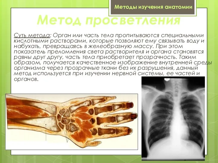 Метод просветления Суть метода: Орган или часть тела пропитываются специальными кислотными растворами,