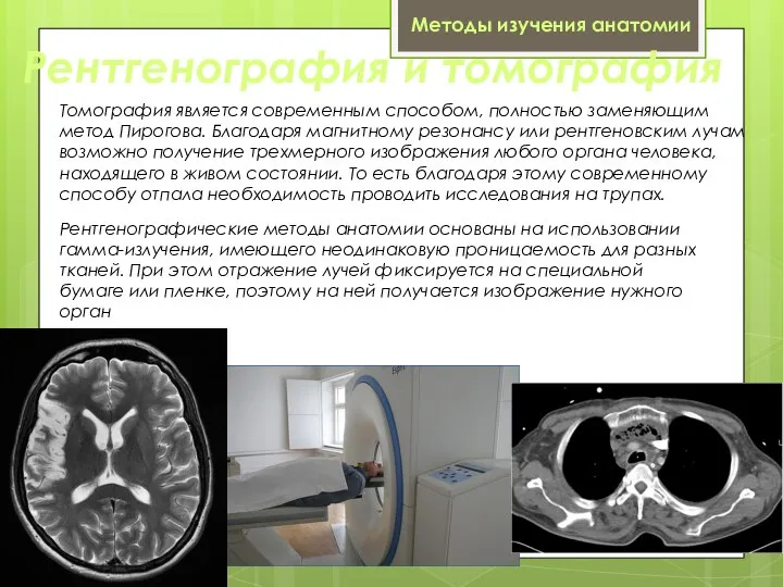 Рентгенография и томография Рентгенографические методы анатомии основаны на использовании гамма-излучения, имеющего неодинаковую