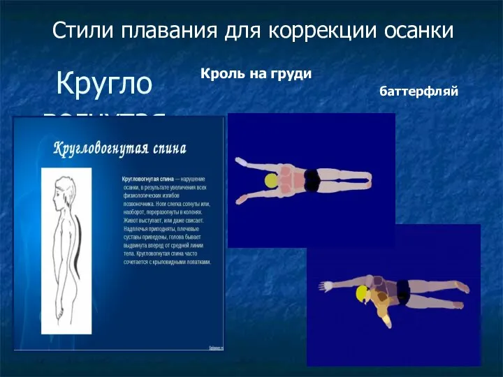 Кругло вогнутая спина Кроль на груди Стили плавания для коррекции осанки баттерфляй