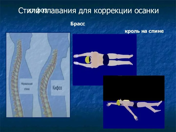 кифоз Брасс кроль на спине Стили плавания для коррекции осанки