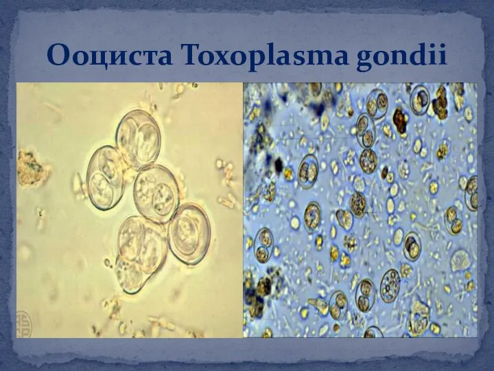 Ооциста Toxoplasma gondii