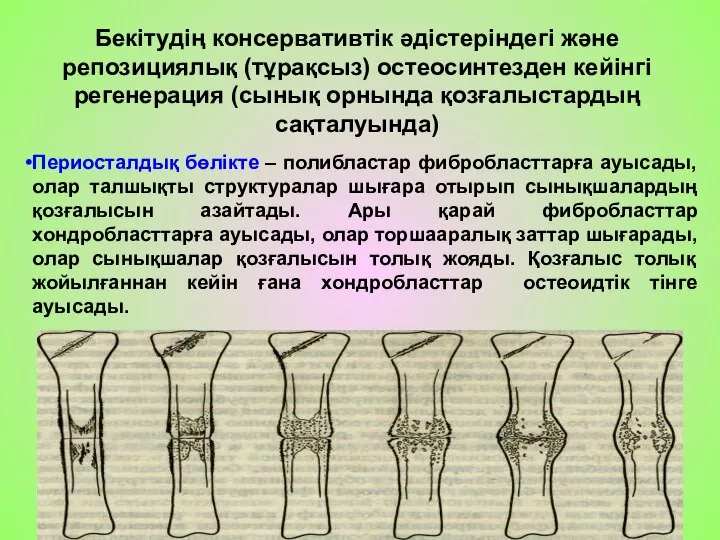 Бекітудің консервативтік әдістеріндегі және репозициялық (тұрақсыз) остеосинтезден кейінгі регенерация (сынық орнында қозғалыстардың