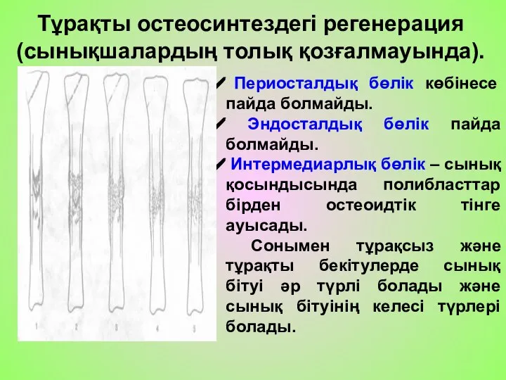 Тұрақты остеосинтездегі регенерация (сынықшалардың толық қозғалмауында). Периосталдық бөлік көбінесе пайда болмайды. Эндосталдық