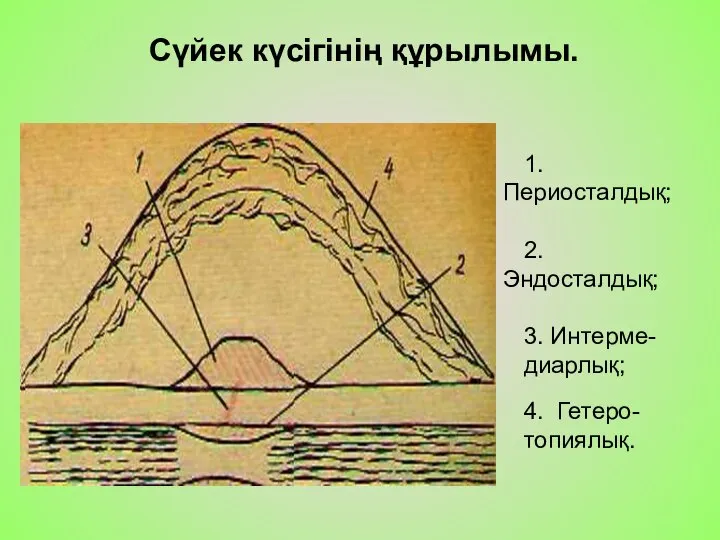 Сүйек күсігінің құрылымы. 1.Периосталдық; 2.Эндосталдық; 3. Интерме- диарлық; 4. Гетеро- топиялық.