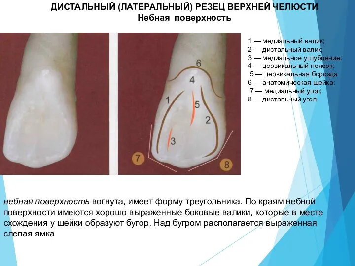 ДИСТАЛЬНЫЙ (ЛАТЕРАЛЬНЫЙ) РЕЗЕЦ ВЕРХНЕЙ ЧЕЛЮСТИ Небная поверхность 1 — медиальный валик; 2