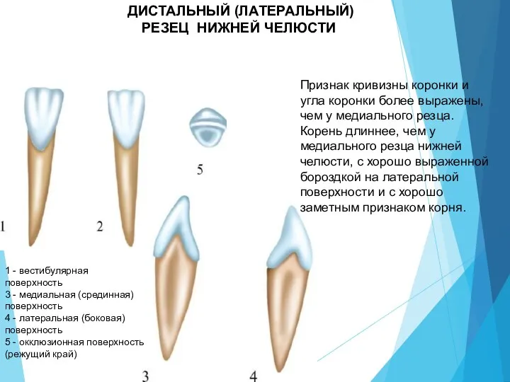 ДИСТАЛЬНЫЙ (ЛАТЕРАЛЬНЫЙ) РЕЗЕЦ НИЖНЕЙ ЧЕЛЮСТИ 1 - вестибулярная поверхность 3 - медиальная