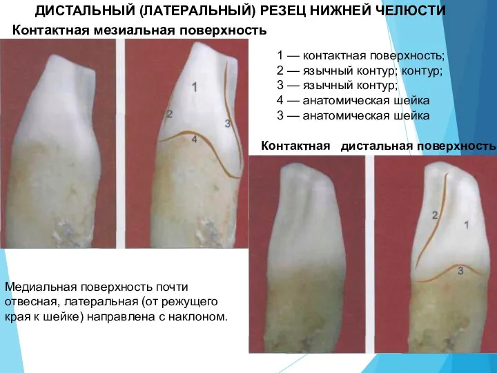 ДИСТАЛЬНЫЙ (ЛАТЕРАЛЬНЫЙ) РЕЗЕЦ НИЖНЕЙ ЧЕЛЮСТИ Контактная мезиальная поверхность Контактная дистальная поверхность 1