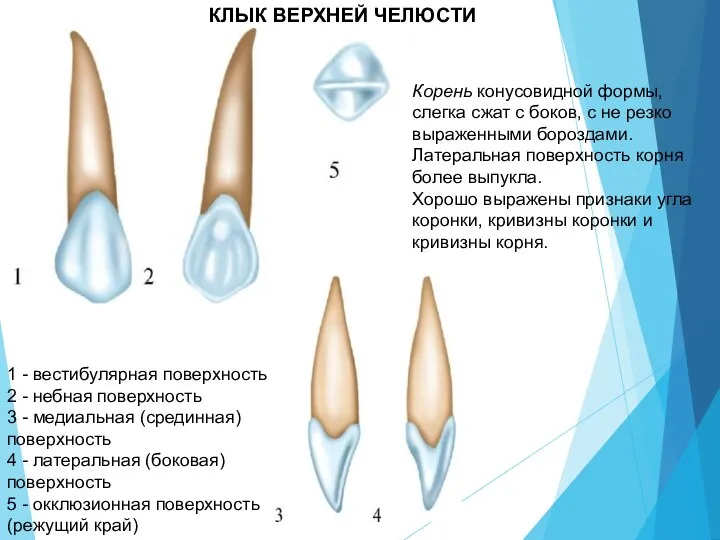 КЛЫК ВЕРХНЕЙ ЧЕЛЮСТИ 1 - вестибулярная поверхность 2 - небная поверхность 3