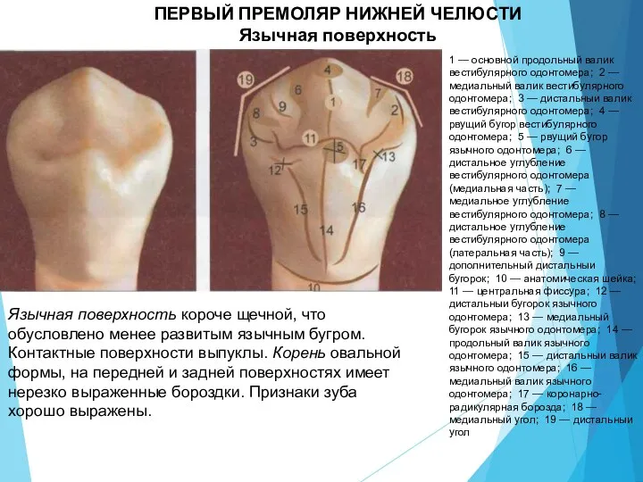 ПЕРВЫЙ ПРЕМОЛЯР НИЖНЕЙ ЧЕЛЮСТИ Язычная поверхность 1 — основной продольный валик вестибулярного