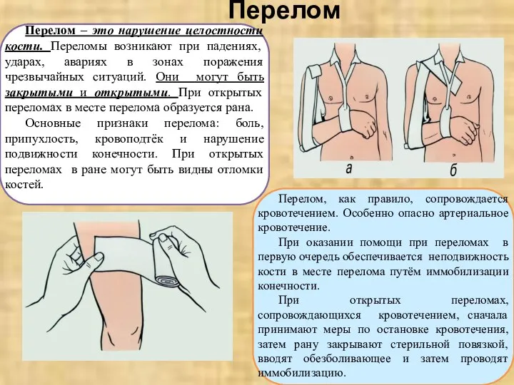 Перелом Перелом – это нарушение целостности кости. Переломы возникают при падениях, ударах,