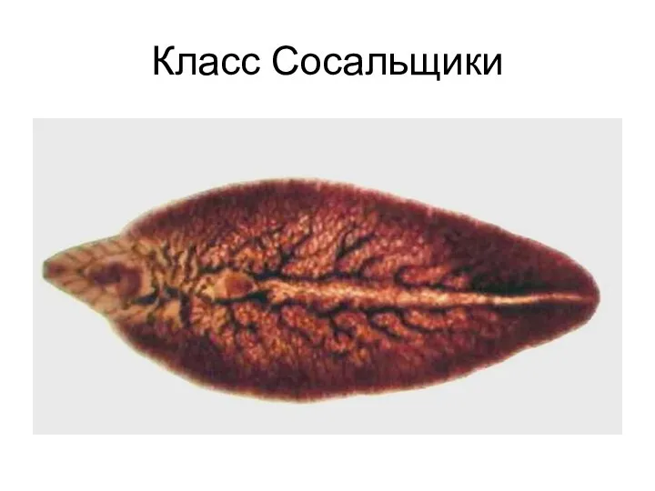 Класс Сосальщики