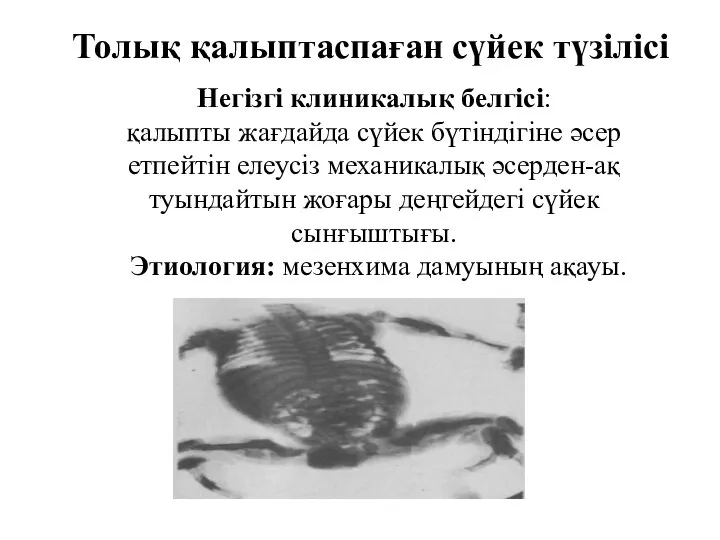 Негізгі клиникалық белгісі: қалыпты жағдайда сүйек бүтіндігіне әсер етпейтін елеусіз механикалық әсерден-ақ