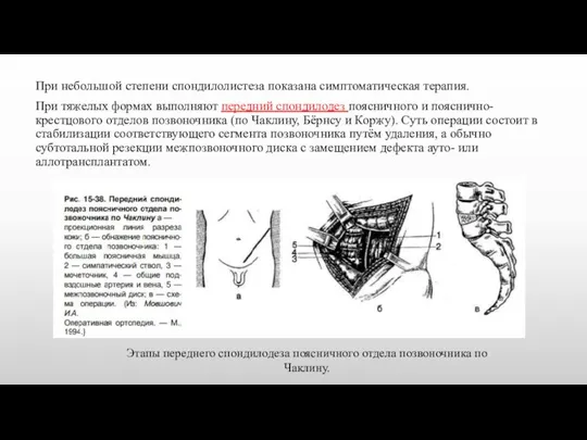 При небольшой степени спондилолистеза показана симптоматическая терапия. При тяжелых формах выполняют передний