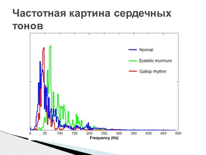 Частотная картина сердечных тонов