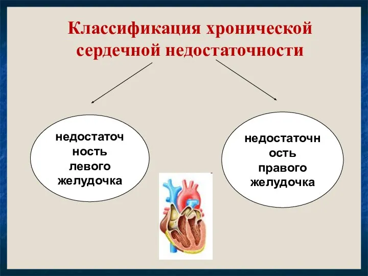 Классификация хронической сердечной недостаточности недостаточность левого желудочка недостаточность правого желудочка