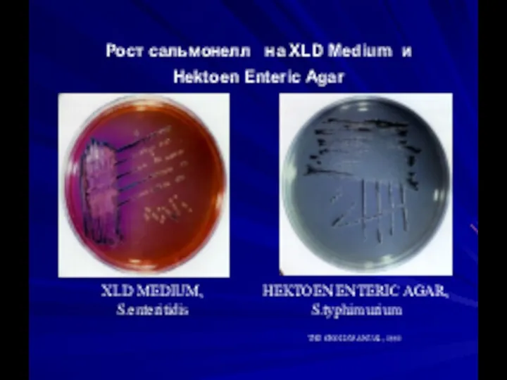 Рост сальмонелл на XLD Medium и Hektoen Enteric Agar XLD MEDIUM, S.enteritidis