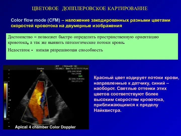 ЦВЕТОВОЕ ДОППЛЕРОВСКОЕ КАРТИРОВАНИЕ Color flow mode (CFM) – наложение закодированных разными цветами