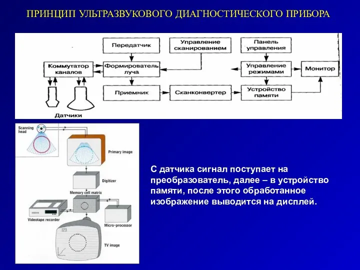 ПРИНЦИП УЛЬТРАЗВУКОВОГО ДИАГНОСТИЧЕСКОГО ПРИБОРА С датчика сигнал поступает на преобразователь, далее –