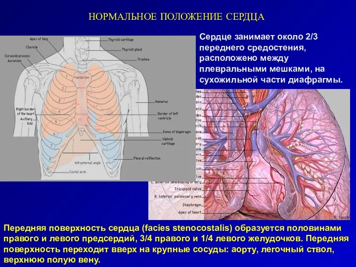 НОРМАЛЬНОЕ ПОЛОЖЕНИЕ СЕРДЦА Передняя поверхность сердца (facies stenocostalis) образуется половинами правого и