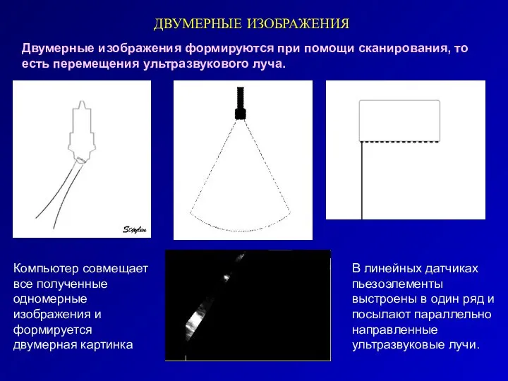 ДВУМЕРНЫЕ ИЗОБРАЖЕНИЯ Двумерные изображения формируются при помощи сканирования, то есть перемещения ультразвукового