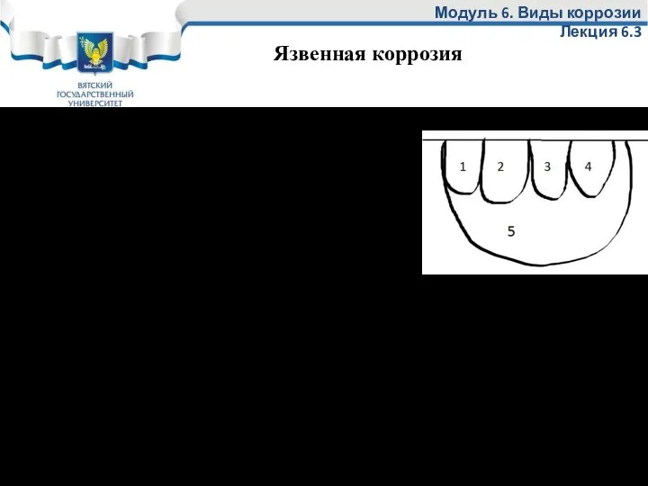 Язва (раковина) это большие образования. Часто бывает так – сначала образуются питтинги