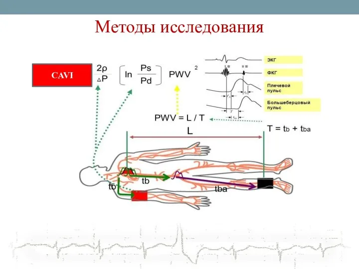 Методы исследования CAVI