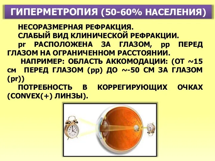 ГИПЕРМЕТРОПИЯ (50-60% НАСЕЛЕНИЯ) НЕСОРАЗМЕРНАЯ РЕФРАКЦИЯ. СЛАБЫЙ ВИД КЛИНИЧЕСКОЙ РЕФРАКЦИИ. pr РАСПОЛОЖЕНА ЗА