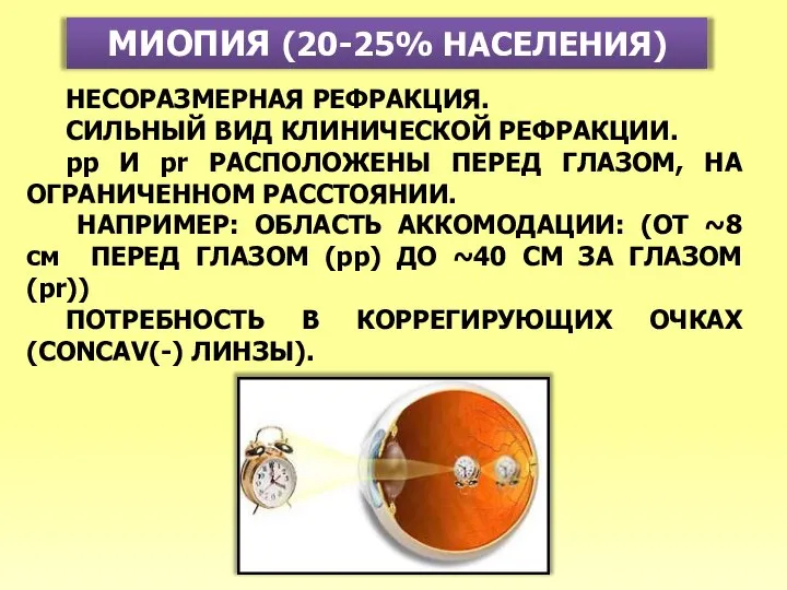 МИОПИЯ (20-25% НАСЕЛЕНИЯ) НЕСОРАЗМЕРНАЯ РЕФРАКЦИЯ. СИЛЬНЫЙ ВИД КЛИНИЧЕСКОЙ РЕФРАКЦИИ. pp И pr