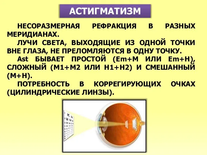 АСТИГМАТИЗМ НЕСОРАЗМЕРНАЯ РЕФРАКЦИЯ В РАЗНЫХ МЕРИДИАНАХ. ЛУЧИ СВЕТА, ВЫХОДЯЩИЕ ИЗ ОДНОЙ ТОЧКИ