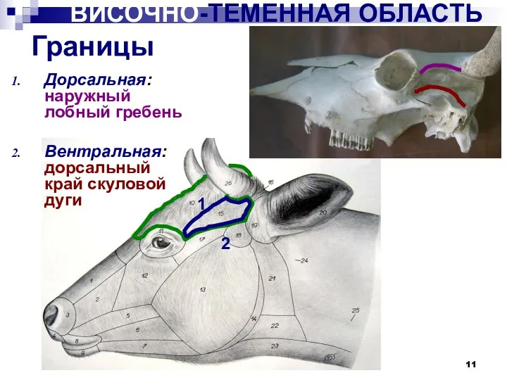 ВИСОЧНО-ТЕМЕННАЯ ОБЛАСТЬ Границы Дорсальная: наружный лобный гребень Вентральная: дорсальный край скуловой дуги 1 2