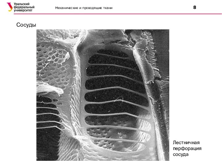 Механические и проводящие ткани 8 Сосуды Лестничная перфорация сосуда