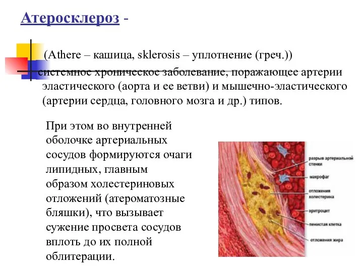 Атеросклероз - (Athere – кашица, sklerosis – уплотнение (греч.)) системное хроническое заболевание,