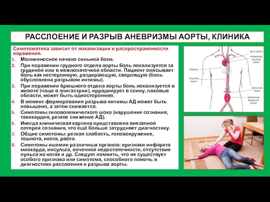 РАССЛОЕНИЕ И РАЗРЫВ АНЕВРИЗМЫ АОРТЫ, КЛИНИКА Симптоматика зависит от локализации и распространенности