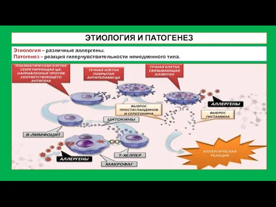 ЭТИОЛОГИЯ И ПАТОГЕНЕЗ Этиология – различные аллергены. Патогенез – реакция гиперчувствительности немедленного типа.