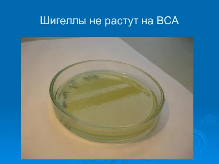 Шигеллы не растут на ВСА