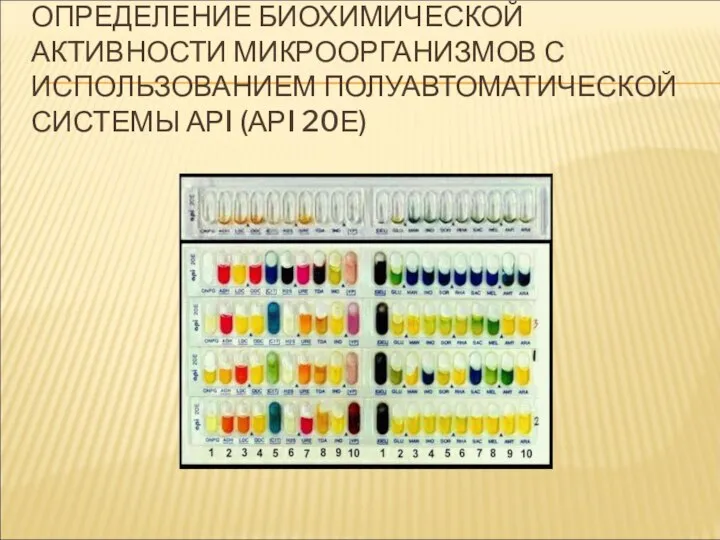 ОПРЕДЕЛЕНИЕ БИОХИМИЧЕСКОЙ АКТИВНОСТИ МИКРООРГАНИЗМОВ С ИСПОЛЬЗОВАНИЕМ ПОЛУАВТОМАТИЧЕСКОЙ СИСТЕМЫ АРI (АРI 20Е)