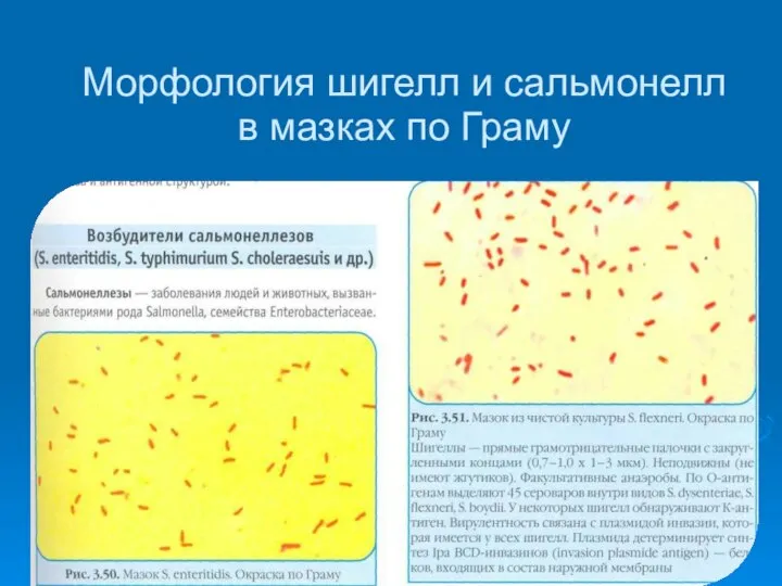 Морфология шигелл и сальмонелл в мазках по Граму