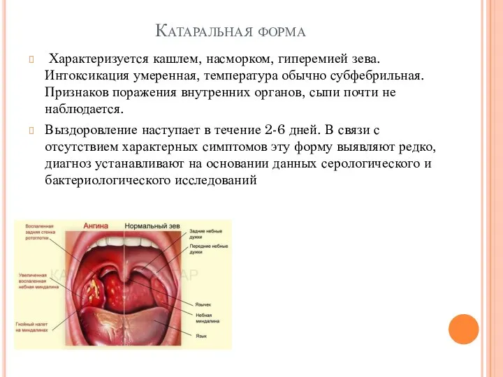 Катаральная форма Характеризуется кашлем, насморком, гиперемией зева. Интоксикация умеренная, температура обычно субфебрильная.