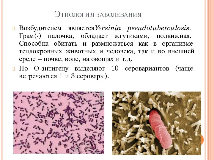 Этиология заболевания Возбудителем являетсяYersinia pseudotuberculosis. Грам(-) палочка, обладает жгутиками, подвижная. Способна обитать